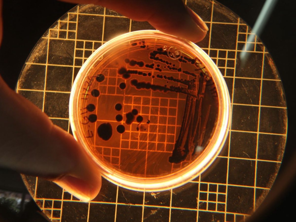 Microbiote intestinal : rôle, alimentation et précautions