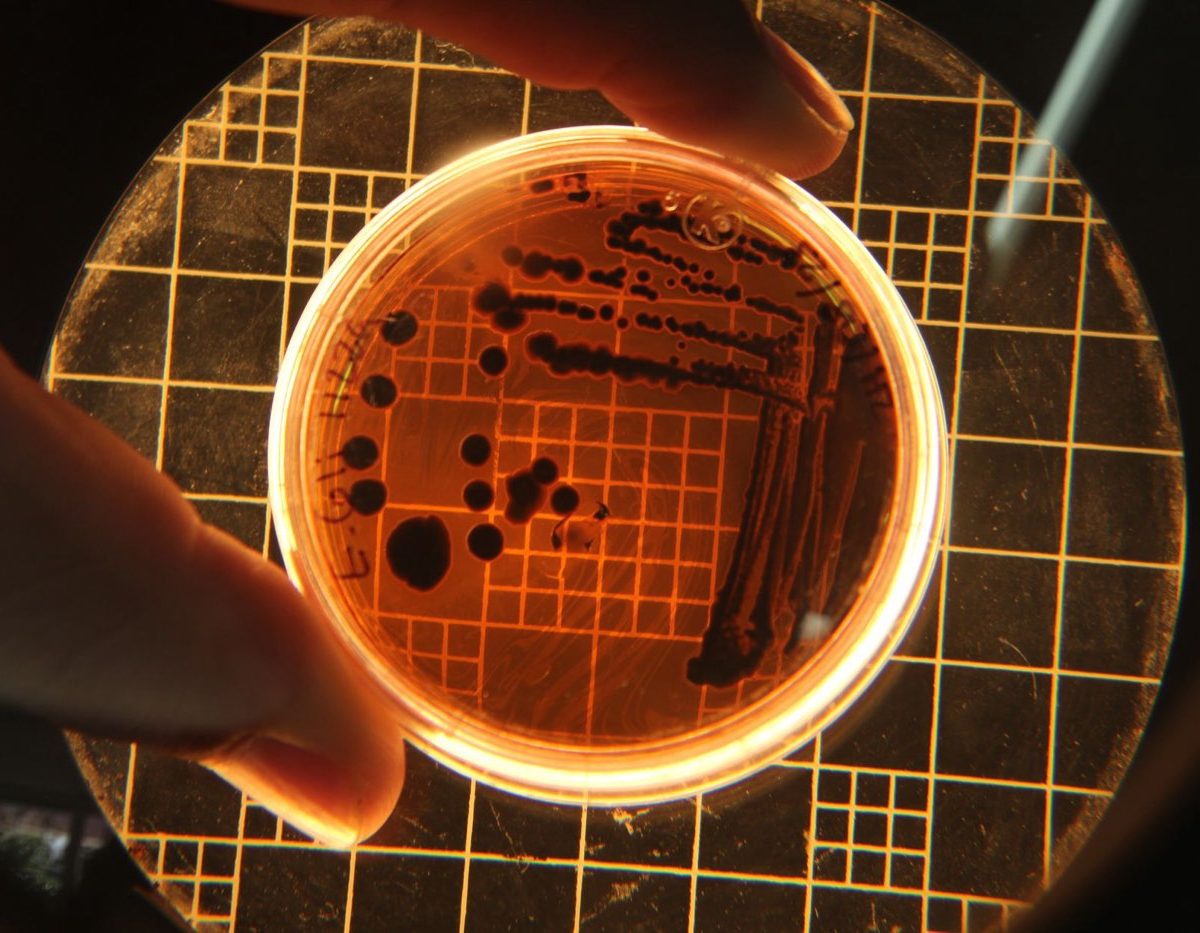 Microbiote intestinal : rôle, alimentation et précautions