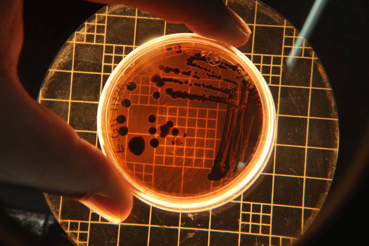 Microbiote intestinal : rôle, alimentation et précautions